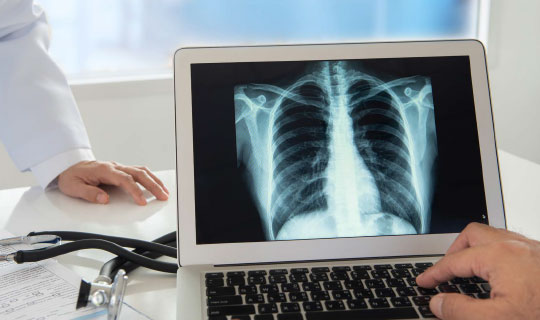 doctors reviewing an x-ray of the patient's chest on a computer screen